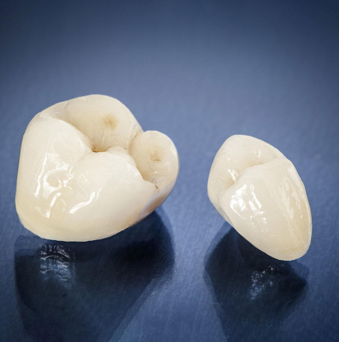 dental metal free crowns